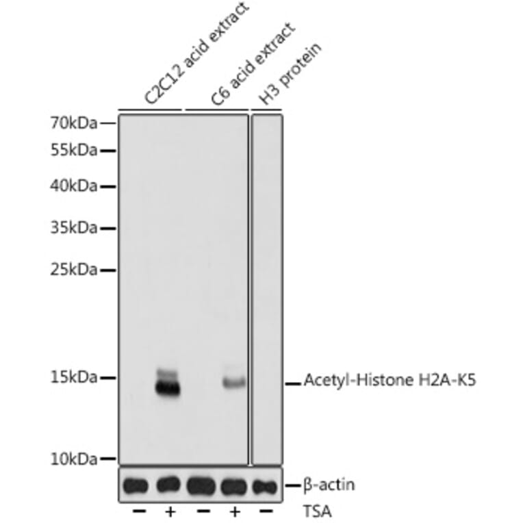 Western Blot - Anti-Histone H2A (acetyl Lys5) Antibody (A91516) - Antibodies.com