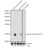 Western Blot - Anti-Histone H2A (acetyl Lys5) Antibody (A91516) - Antibodies.com