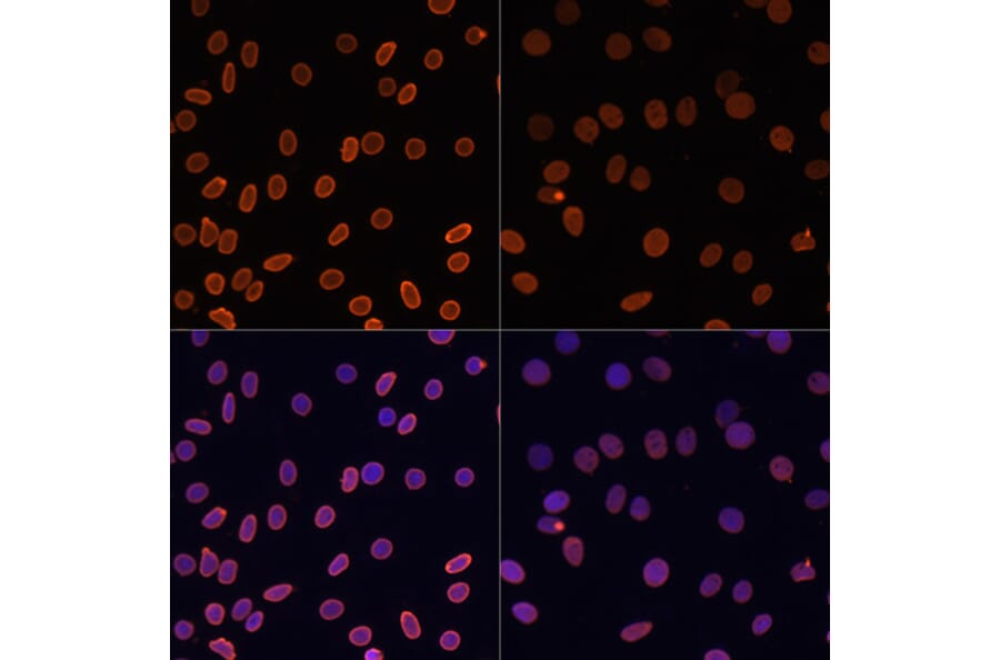 Immunofluorescence - Anti-Histone H2A (acetyl Lys5) Antibody (A91516) - Antibodies.com