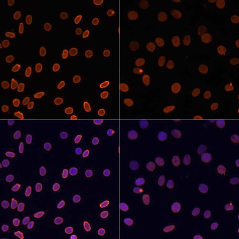Immunofluorescence - Anti-Histone H2A (acetyl Lys5) Antibody (A91516) - Antibodies.com