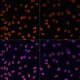 Immunofluorescence - Anti-Histone H2A (acetyl Lys5) Antibody (A91516) - Antibodies.com