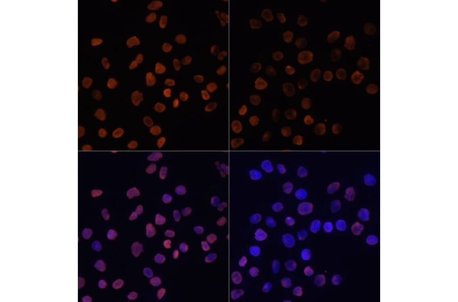 Immunofluorescence - Anti-Histone H2A (acetyl Lys5) Antibody (A91516) - Antibodies.com