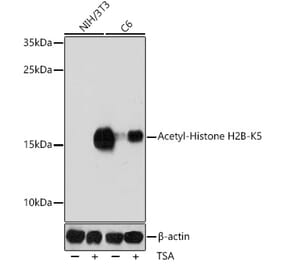 Western Blot - Anti-Histone H2B (acetyl Lys5) Antibody (A91518) - Antibodies.com