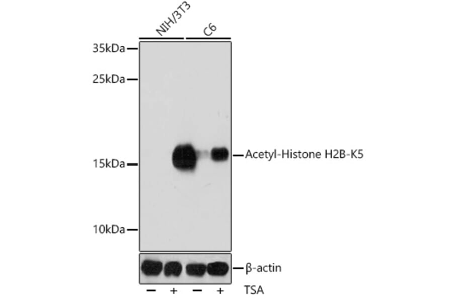 Western Blot - Anti-Histone H2B (acetyl Lys5) Antibody (A91518) - Antibodies.com