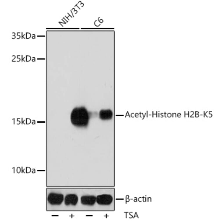 Western Blot - Anti-Histone H2B (acetyl Lys5) Antibody (A91518) - Antibodies.com