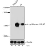 Western Blot - Anti-Histone H2B (acetyl Lys5) Antibody (A91518) - Antibodies.com
