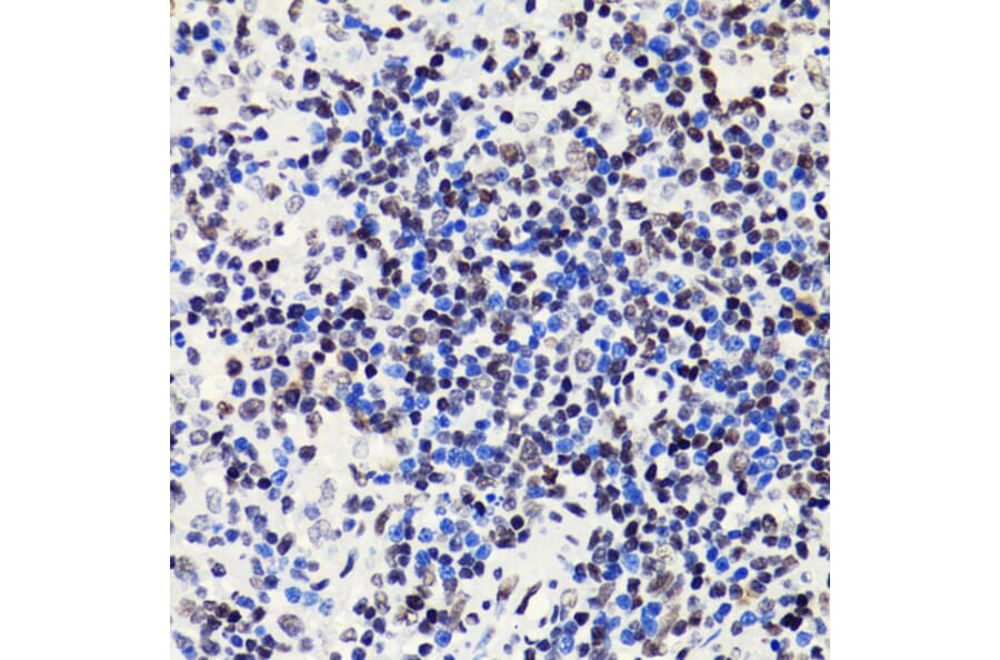 Immunohistochemistry - Anti-Histone H2B (acetyl Lys5) Antibody (A91518) - Antibodies.com
