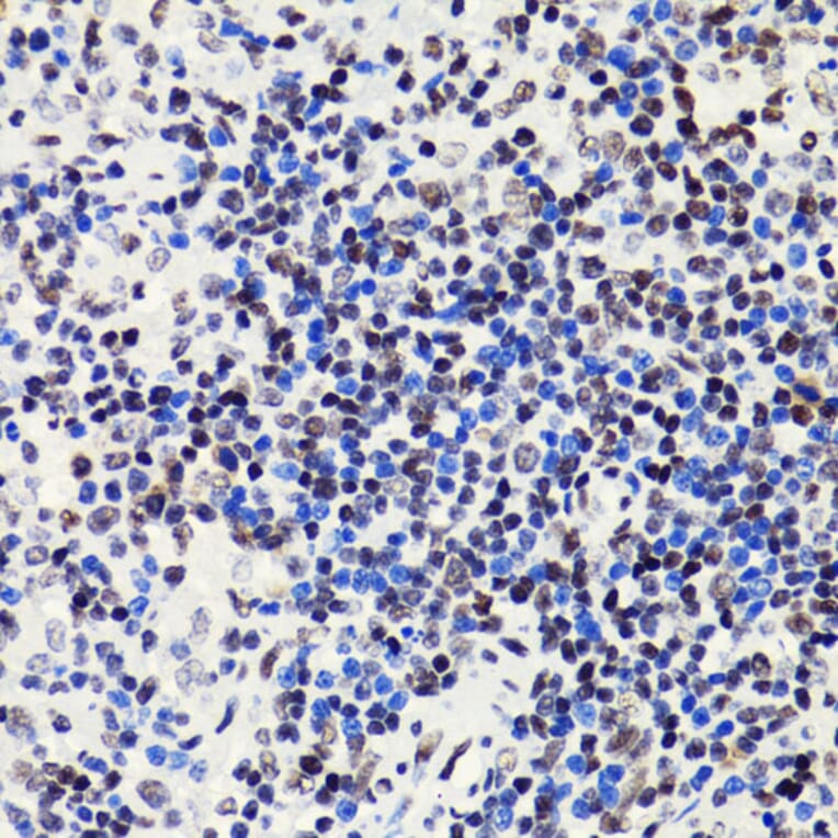 Immunohistochemistry - Anti-Histone H2B (acetyl Lys5) Antibody (A91518) - Antibodies.com