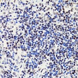 Immunohistochemistry - Anti-Histone H2B (acetyl Lys5) Antibody (A91518) - Antibodies.com