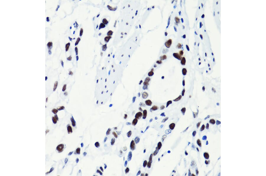 Immunohistochemistry - Anti-Histone H2B (acetyl Lys5) Antibody (A91518) - Antibodies.com