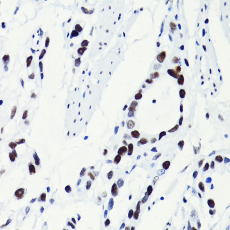 Immunohistochemistry - Anti-Histone H2B (acetyl Lys5) Antibody (A91518) - Antibodies.com