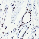Immunohistochemistry - Anti-Histone H2B (acetyl Lys5) Antibody (A91518) - Antibodies.com