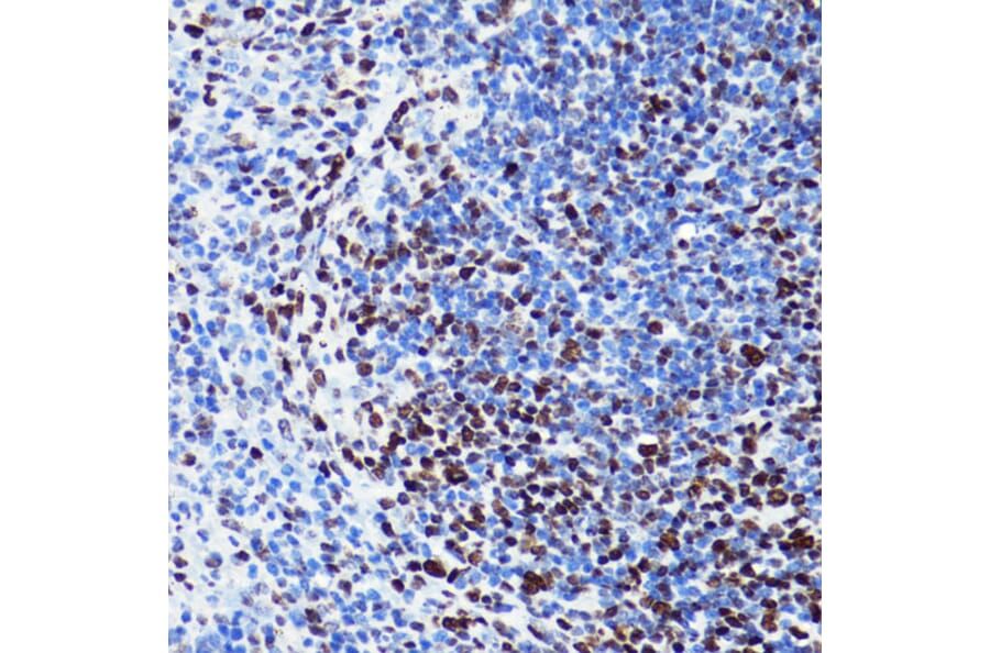 Immunohistochemistry - Anti-Histone H2B (acetyl Lys5) Antibody (A91518) - Antibodies.com