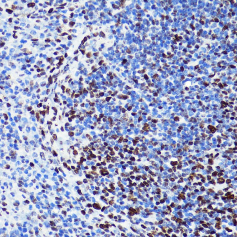Immunohistochemistry - Anti-Histone H2B (acetyl Lys5) Antibody (A91518) - Antibodies.com
