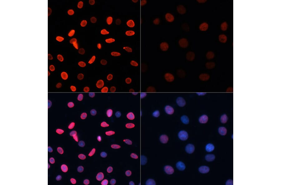 Immunofluorescence - Anti-Histone H2B (acetyl Lys5) Antibody (A91518) - Antibodies.com