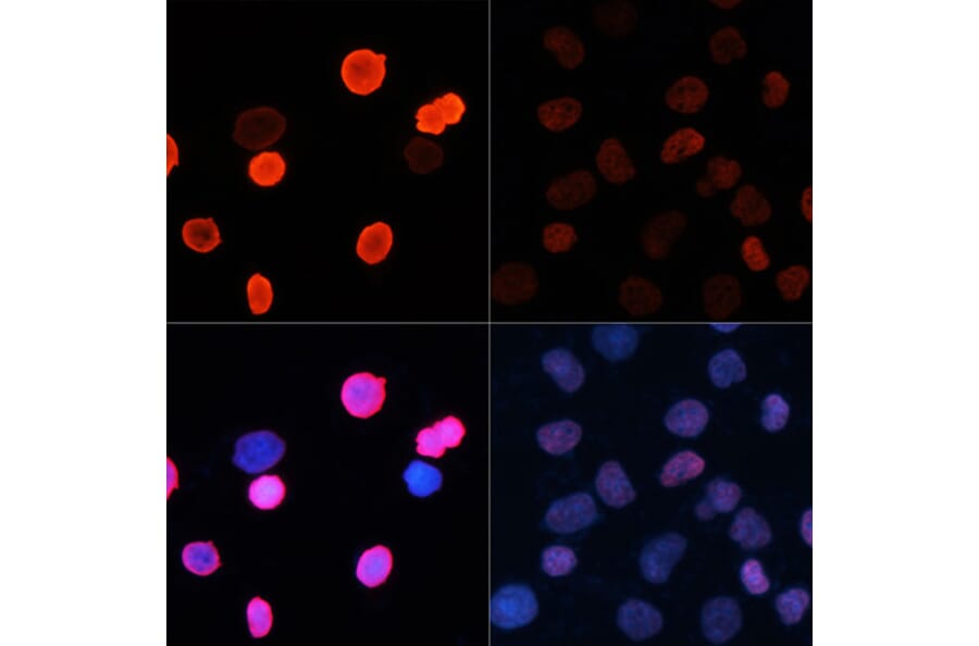 Immunofluorescence - Anti-Histone H2B (acetyl Lys5) Antibody (A91518) - Antibodies.com