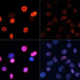 Immunofluorescence - Anti-Histone H2B (acetyl Lys5) Antibody (A91518) - Antibodies.com