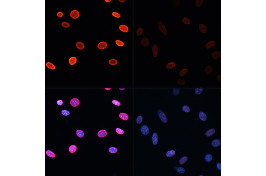 Immunofluorescence - Anti-Histone H2B (acetyl Lys5) Antibody (A91518) - Antibodies.com
