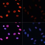 Immunofluorescence - Anti-Histone H2B (acetyl Lys5) Antibody (A91518) - Antibodies.com