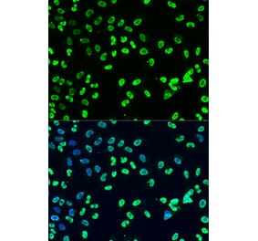 Immunofluorescence - Anti-Dnmt3a (di methyl Lys44) Antibody (A91519) - Antibodies.com