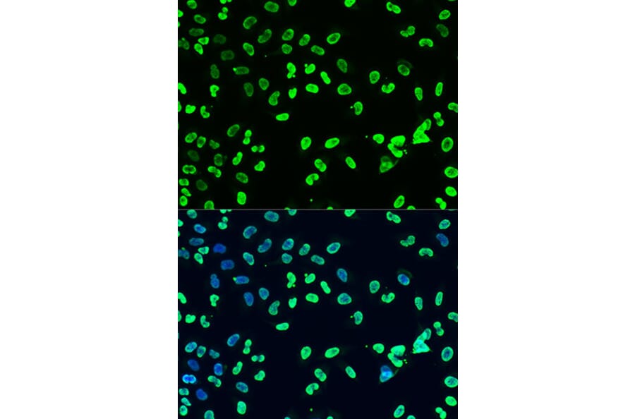 Immunofluorescence - Anti-Dnmt3a (di methyl Lys44) Antibody (A91519) - Antibodies.com