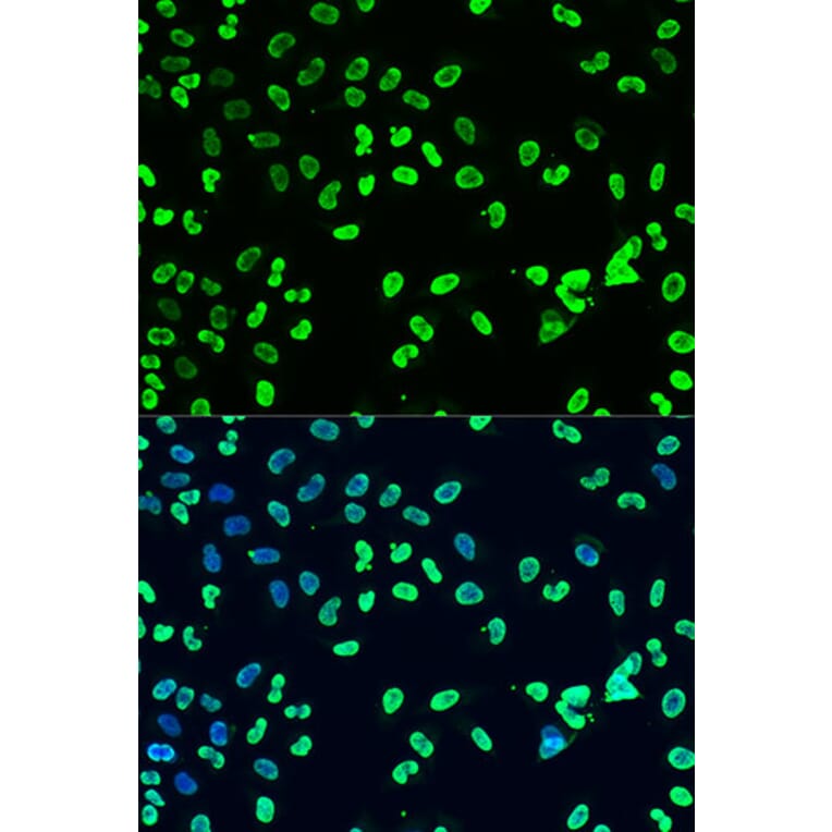 Immunofluorescence - Anti-Dnmt3a (di methyl Lys44) Antibody (A91519) - Antibodies.com