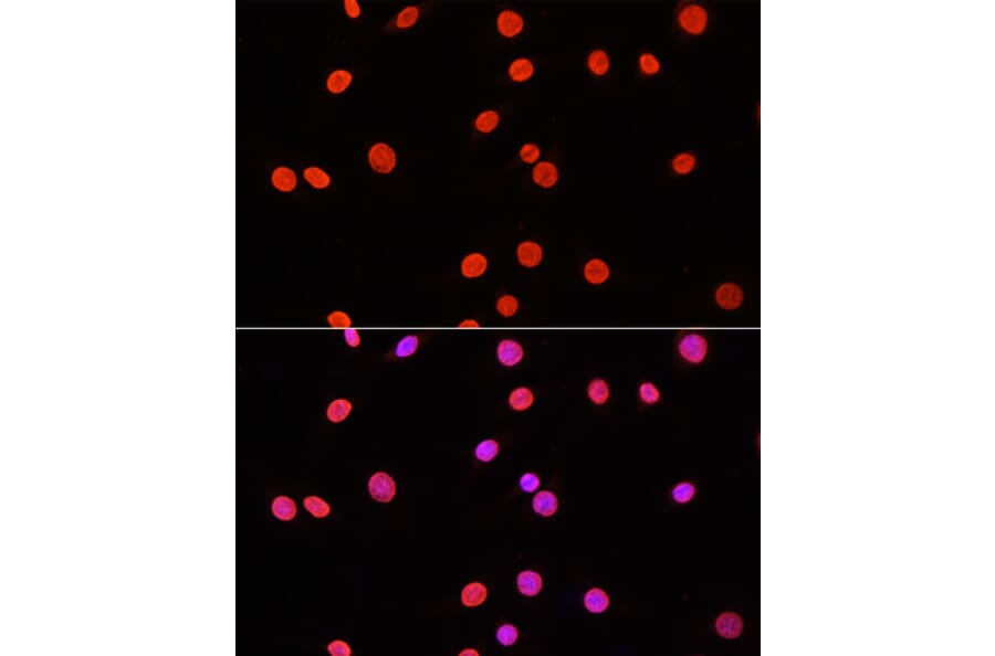Immunofluorescence - Anti-Dnmt3a (di methyl Lys44) Antibody (A91519) - Antibodies.com