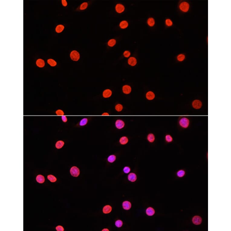 Immunofluorescence - Anti-Dnmt3a (di methyl Lys44) Antibody (A91519) - Antibodies.com