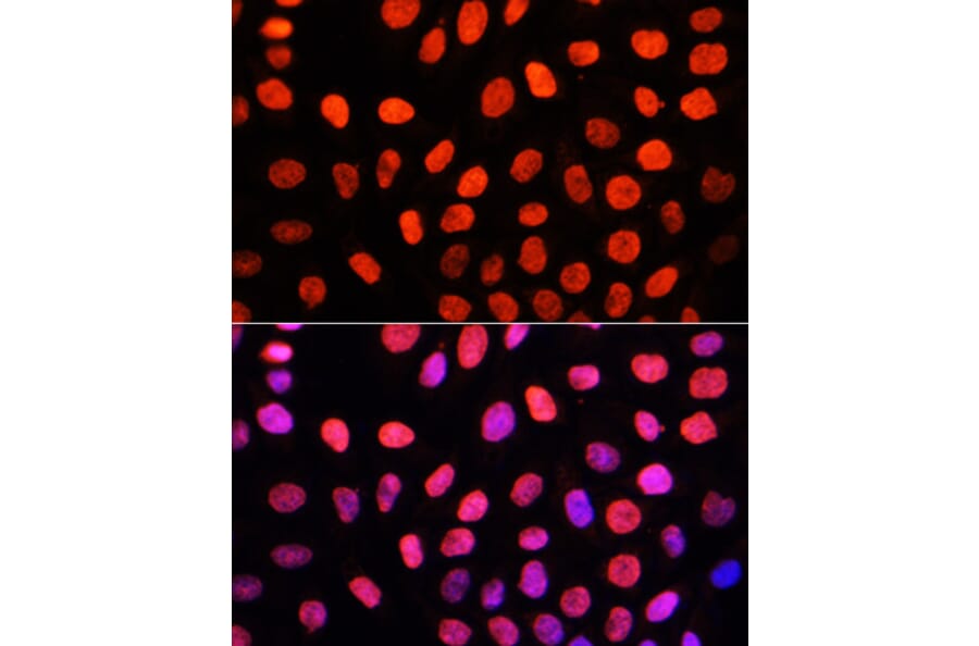 Immunofluorescence - Anti-Dnmt3a (di methyl Lys44) Antibody (A91519) - Antibodies.com