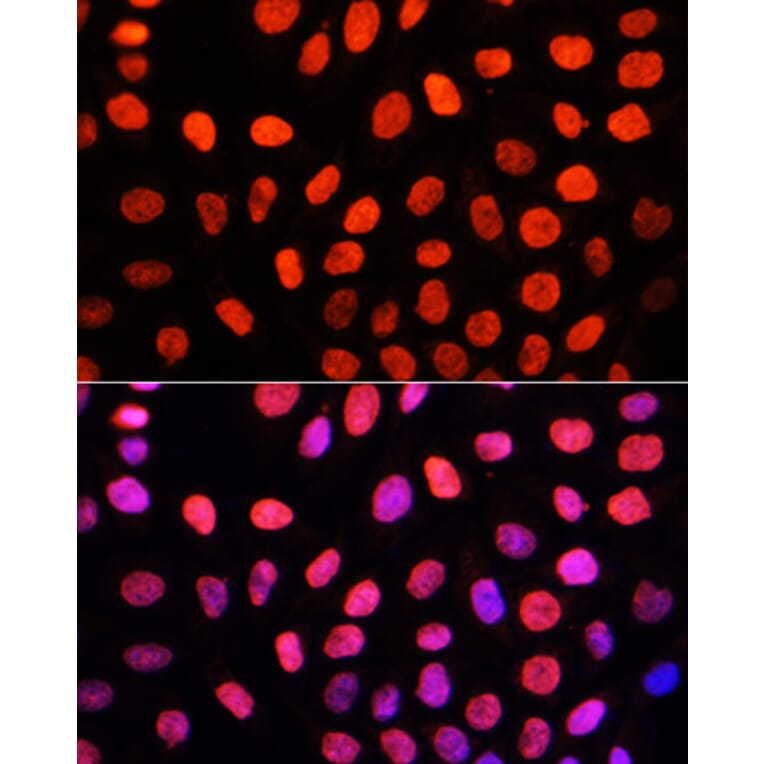 Immunofluorescence - Anti-Dnmt3a (di methyl Lys44) Antibody (A91519) - Antibodies.com