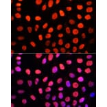 Immunofluorescence - Anti-Dnmt3a (di methyl Lys44) Antibody (A91519) - Antibodies.com