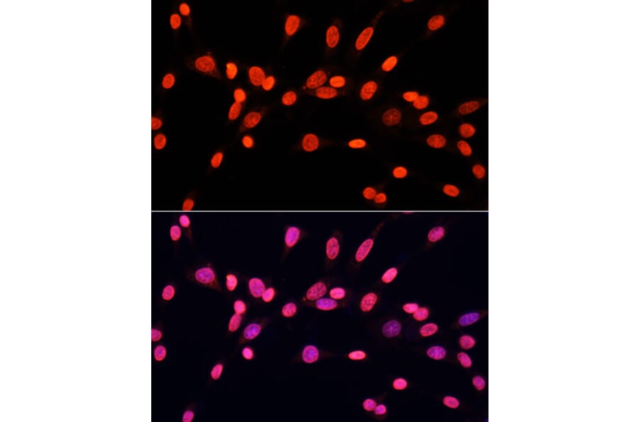 Immunofluorescence - Anti-Dnmt3a (di methyl Lys44) Antibody (A91519) - Antibodies.com