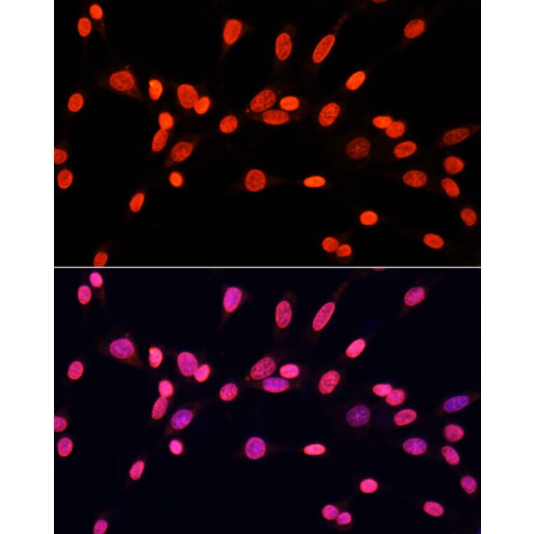 Immunofluorescence - Anti-Dnmt3a (di methyl Lys44) Antibody (A91519) - Antibodies.com