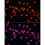 Immunofluorescence - Anti-Dnmt3a (di methyl Lys44) Antibody (A91519) - Antibodies.com