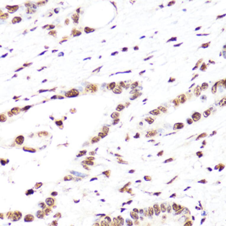 Immunohistochemistry - Anti-Histone H3 Antibody [AMC0015] (A91520) - Antibodies.com