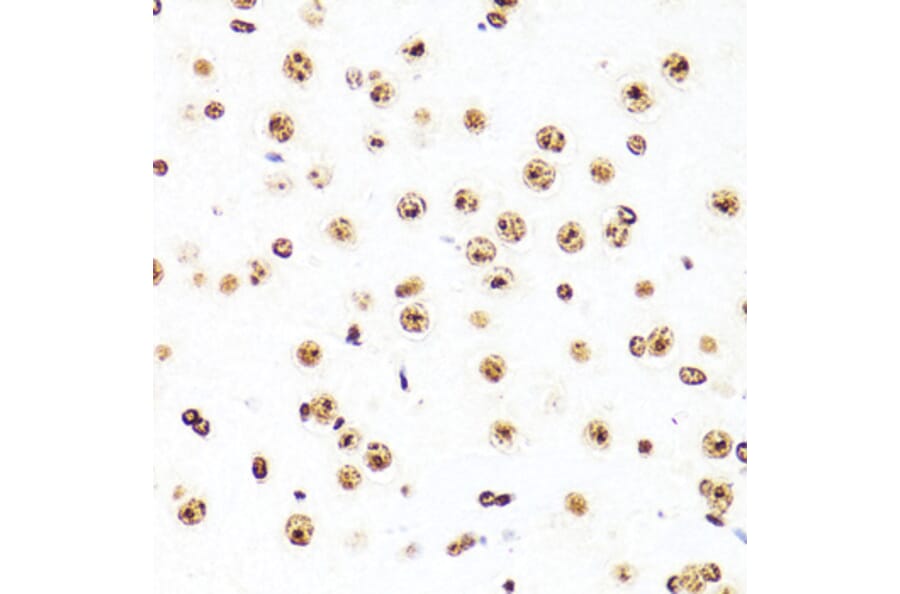 Immunohistochemistry - Anti-Histone H3 Antibody [AMC0015] (A91520) - Antibodies.com