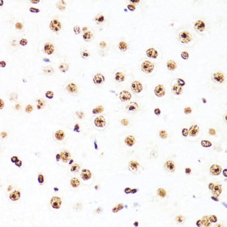 Immunohistochemistry - Anti-Histone H3 Antibody [AMC0015] (A91520) - Antibodies.com