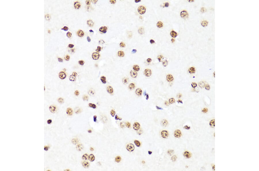 Immunohistochemistry - Anti-Histone H3 Antibody [AMC0015] (A91520) - Antibodies.com