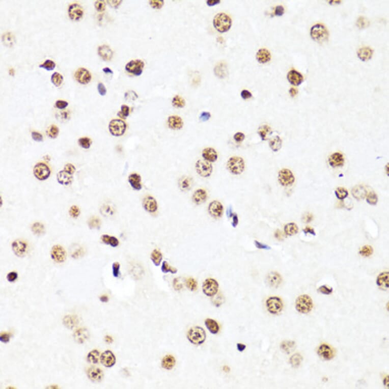 Immunohistochemistry - Anti-Histone H3 Antibody [AMC0015] (A91520) - Antibodies.com