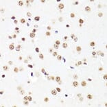 Immunohistochemistry - Anti-Histone H3 Antibody [AMC0015] (A91520) - Antibodies.com