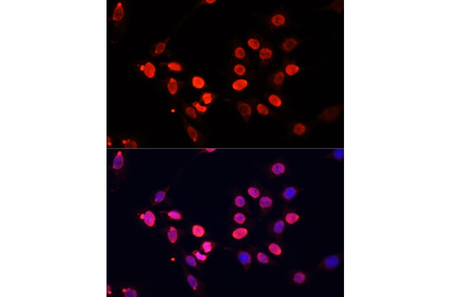Immunofluorescence - Anti-Histone H3 Antibody [AMC0015] (A91520) - Antibodies.com