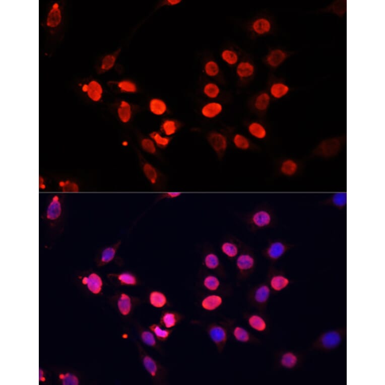Immunofluorescence - Anti-Histone H3 Antibody [AMC0015] (A91520) - Antibodies.com