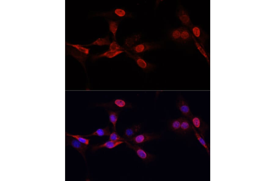 Immunofluorescence - Anti-Histone H3 Antibody [AMC0015] (A91520) - Antibodies.com