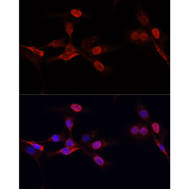 Immunofluorescence - Anti-Histone H3 Antibody [AMC0015] (A91520) - Antibodies.com
