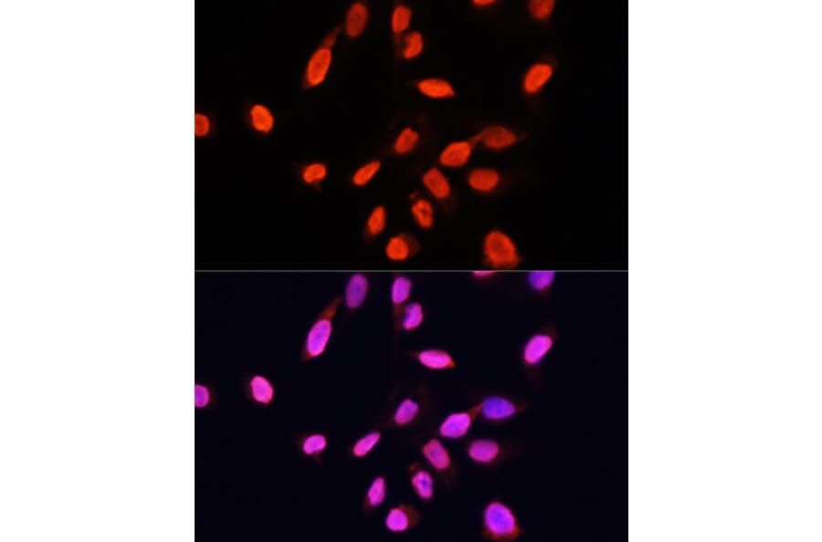 Immunofluorescence - Anti-Histone H3 Antibody [AMC0015] (A91520) - Antibodies.com