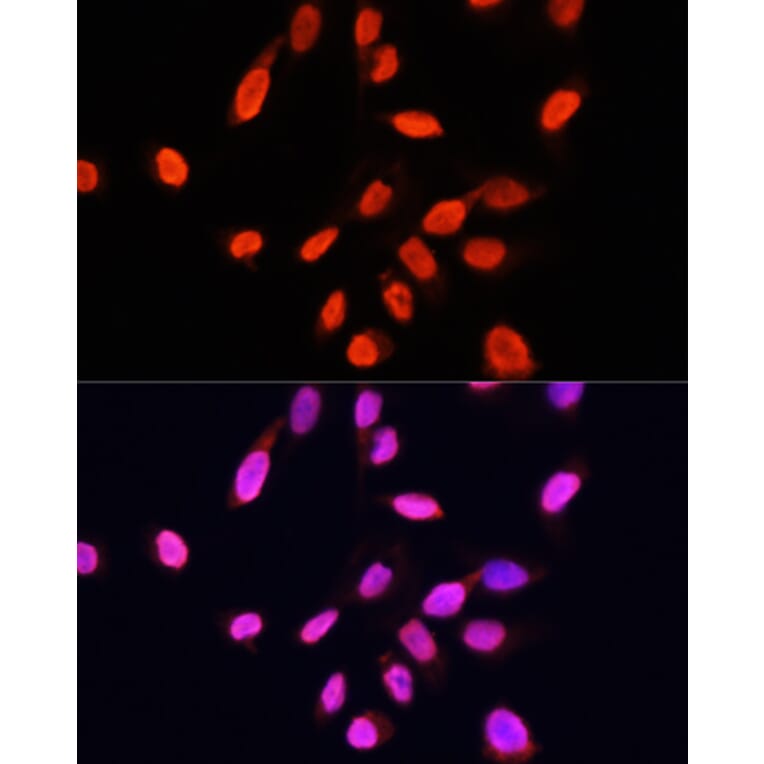 Immunofluorescence - Anti-Histone H3 Antibody [AMC0015] (A91520) - Antibodies.com