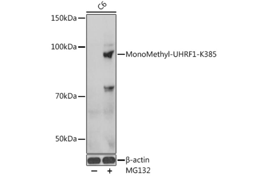 Western Blot - Anti-UHRF1 Antibody (A91521) - Antibodies.com