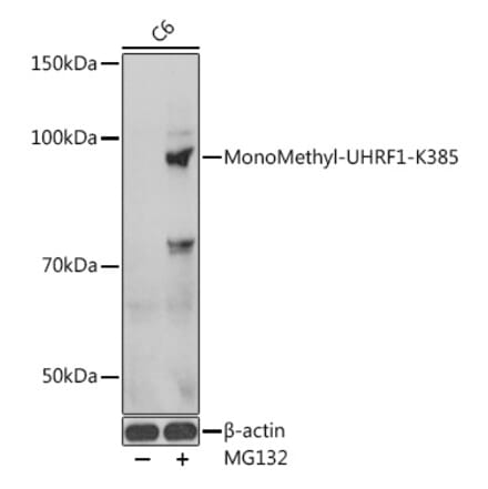 Western Blot - Anti-UHRF1 Antibody (A91521) - Antibodies.com