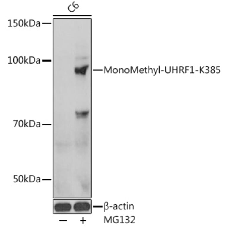 Western Blot - Anti-UHRF1 Antibody (A91521) - Antibodies.com