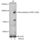 Western Blot - Anti-UHRF1 Antibody (A91521) - Antibodies.com